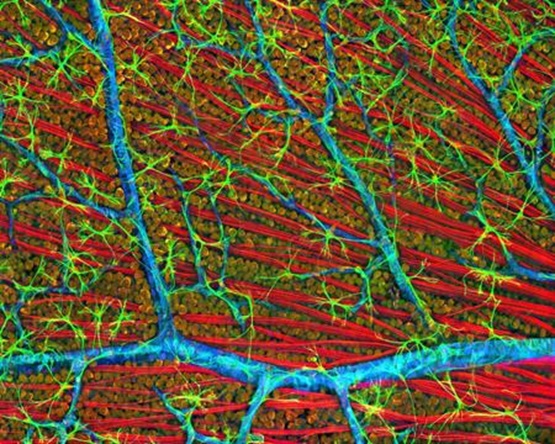 Microfotografía confocal de la retina del ratón que representa la capa de fibra óptica. Imagen cortesía del Centro Nacional de Investigación en Microscopía e Imágenes, UC San Diego.