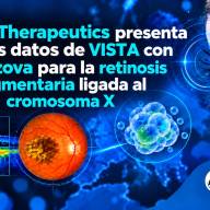 Beacon Therapeutics presenta nuevos datos de VISTA con laru-zova para la retinosis pigmentaria ligada al cromosoma X